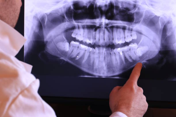 Best Mobile Emergency Dentist in Bret Harte, CA