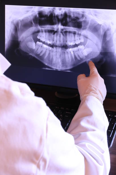 Best Pediatric Emergency Dentist in Bret Harte, CA