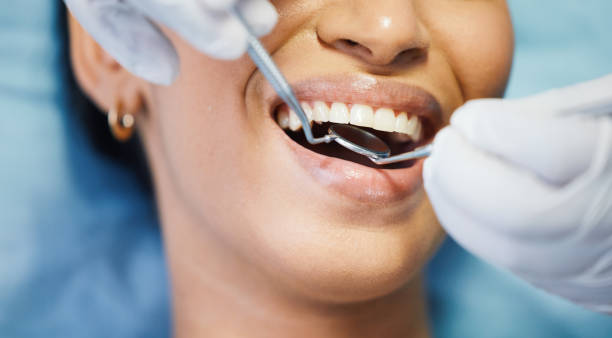 Best Emergency Root Canal Treatment in Bret Harte, CA