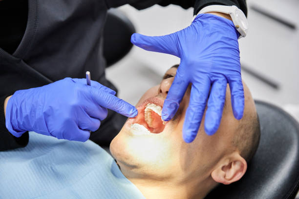 Best Emergency Dentist for Knocked-Out Tooth in Bret Harte, CA